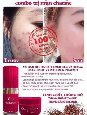 Serum Mụn Hàn Quốc Charme Anti Acne 15ml - 8809273480227