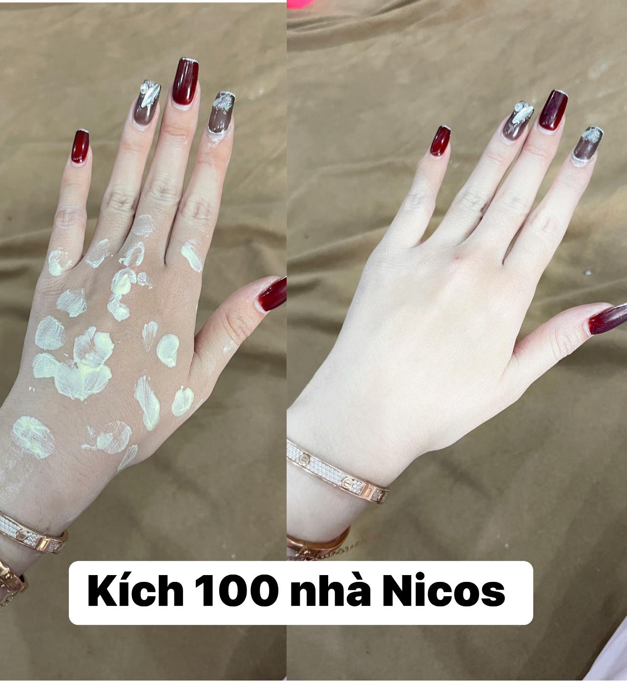 Kem Kích Trắng 100 Alpha Arbutin Thanh Nhi Nikos Beauty