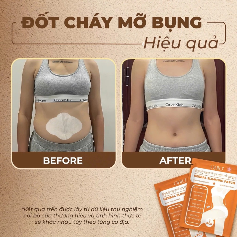 Miếng Dán Tan Mỡ Đông Y Tây Tạng Ohio Slimming Patch