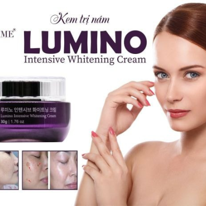 Kem Nám Hàn Quốc Charme Lumino Intensive Whitening Cream điều trị hiệu quả cho tất cả các dạng nám tàn nhang và đốm nâu
