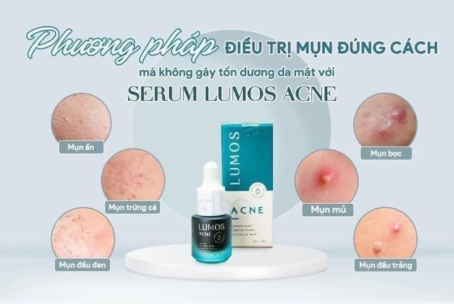 Serum trị mụn Lumos mẫu mới  Chưa 1 dòng trị mụn nào qua được e luôn