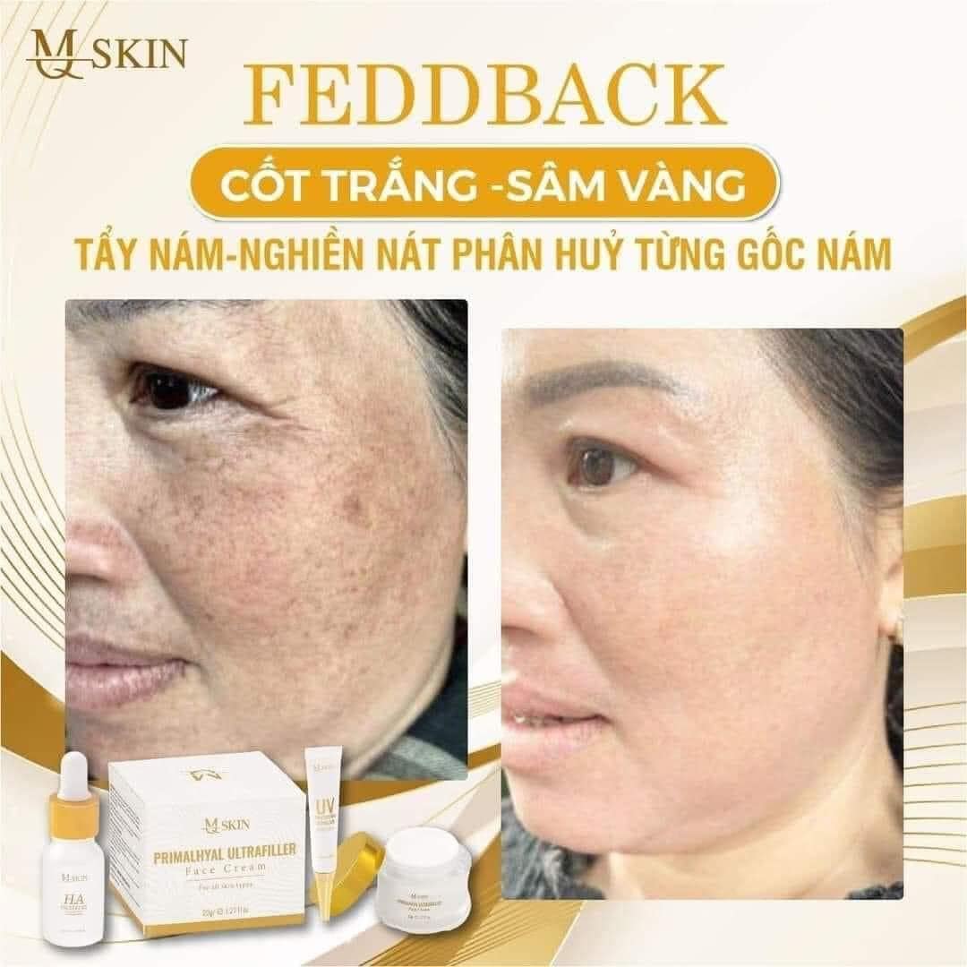 Combo Kem Face Sâm Vàng MQ Skin chính hãng