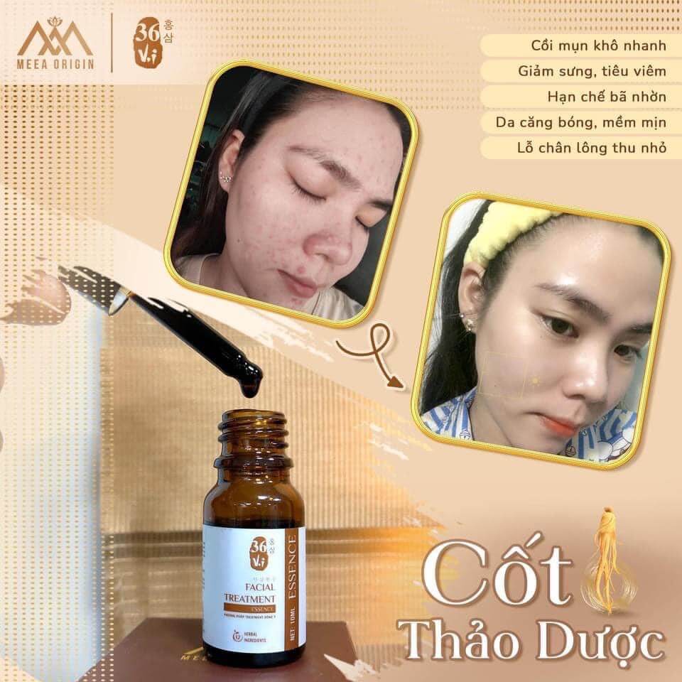 Serum Cốt Huyết Thanh Thảo Dược 36 Vị Full 10ml MeeA Origin