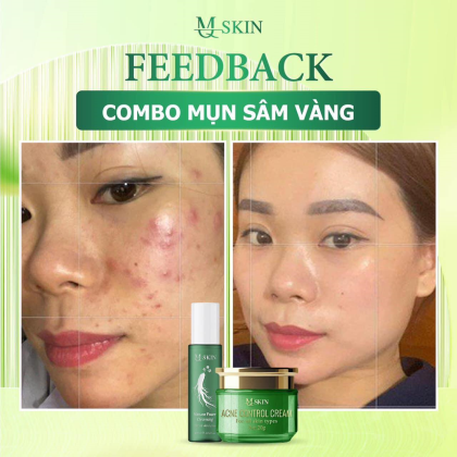 Combo Cao Mụn Sâm Vàng MQ Skin Phục hồi dưỡng trắng mịn da