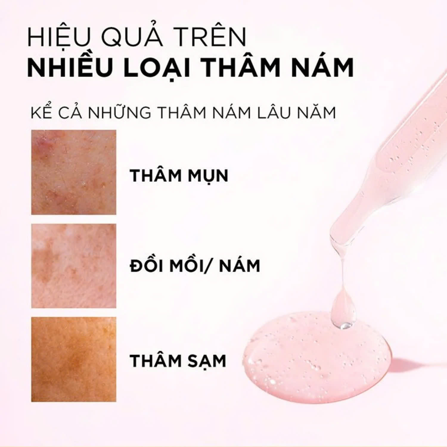 Tới mùa rồi, dưỡng trắng thôi Serum Dưỡng Sáng Da Mờ Thâm Nám Loreal Glycolic Bright 8%