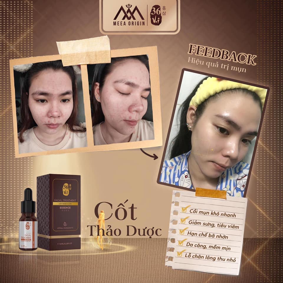 Tinh chất cốt thảo dược 36 Vị full 10ml MeeA Origin chính hãng