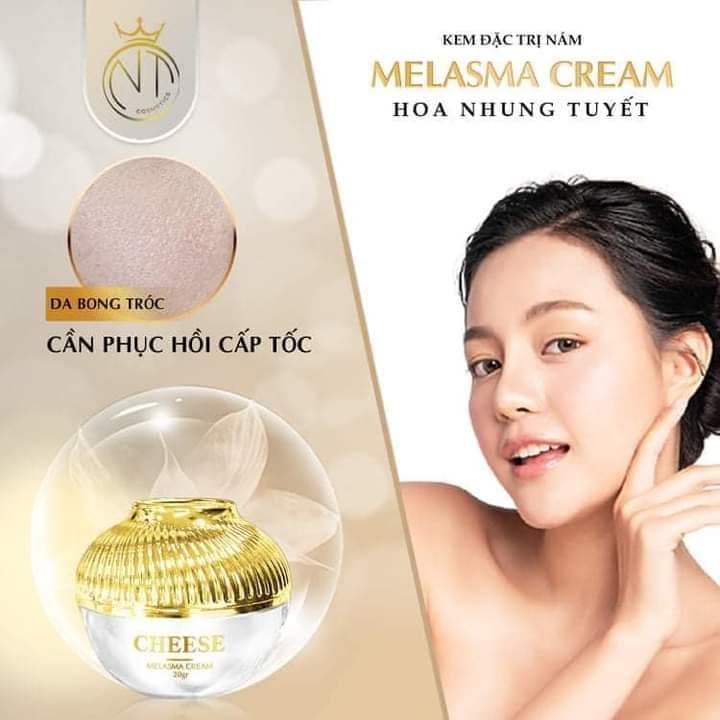 Đẩy lùi nám sạm tự tin khoe da cùng Kem đặc trị nám Cheese Melasma Cream