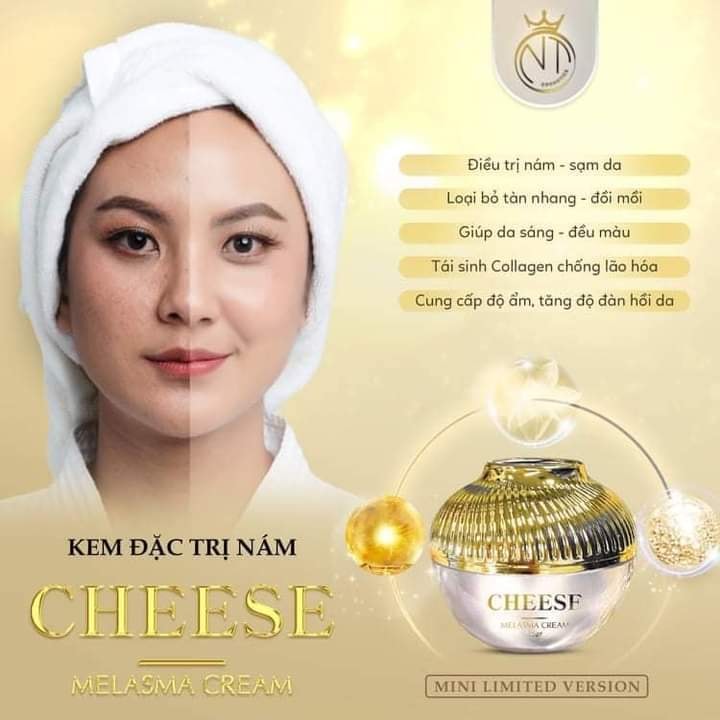 Say goodbye nám cùng kem đặc trị nám Cheese Melasma Cream