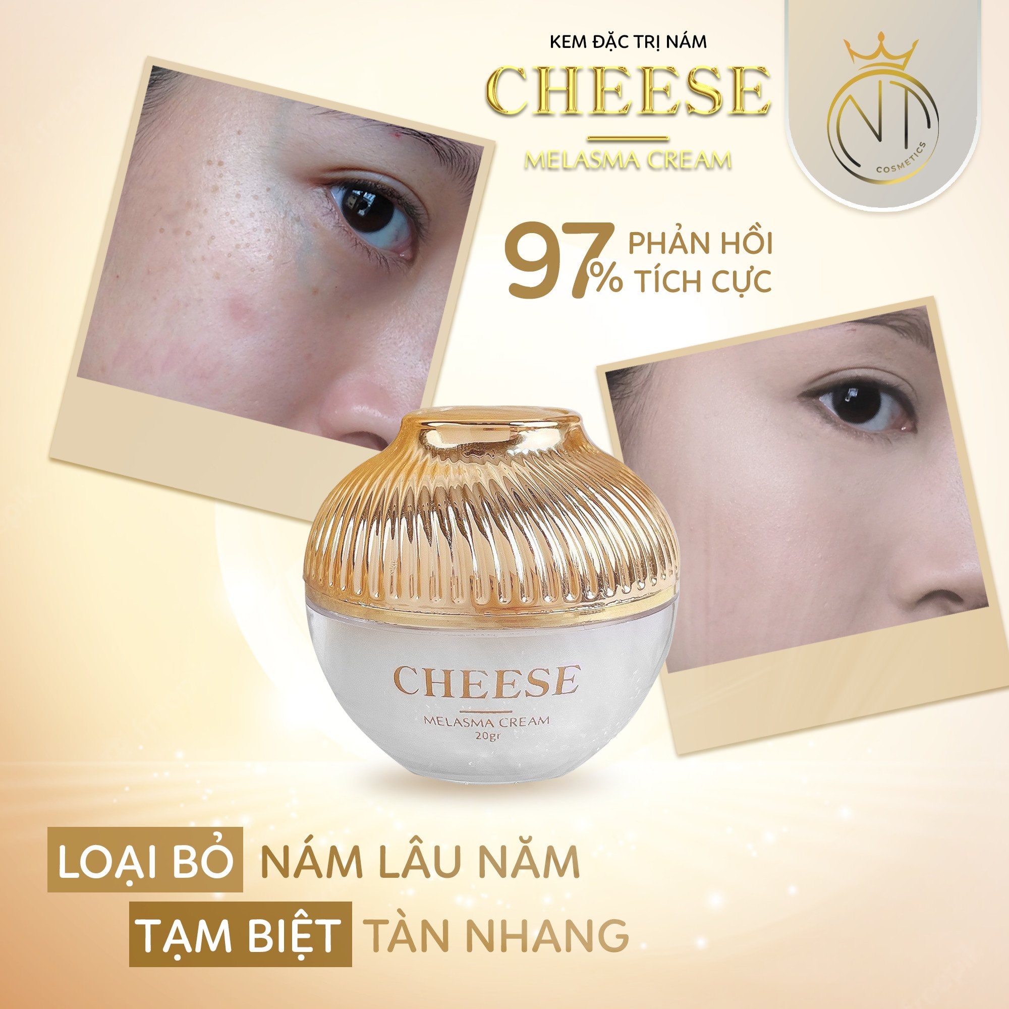 Hết thâm nám - dám tự tin - dám bứt phá khi có Melasma Cream Cheese