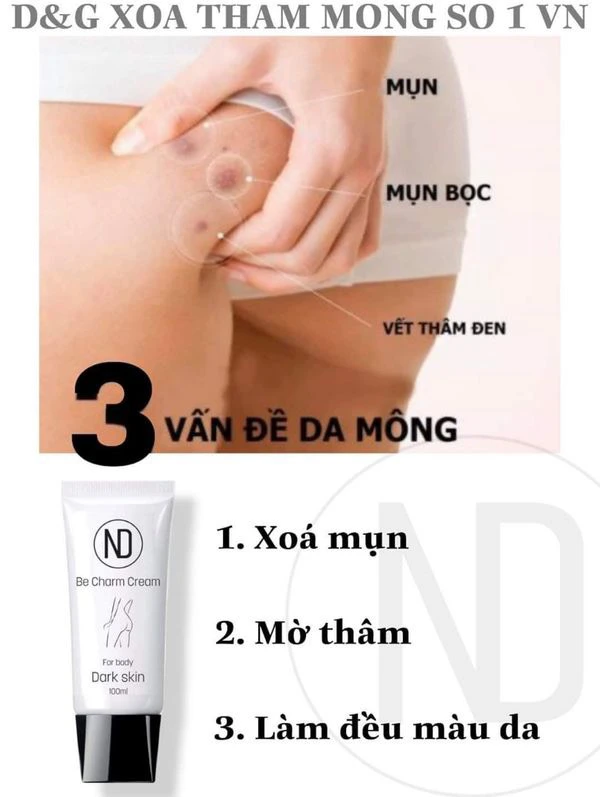 Tất Tần Tật về Kem Trị Thâm Body Be Charm Cream 6 in 1!