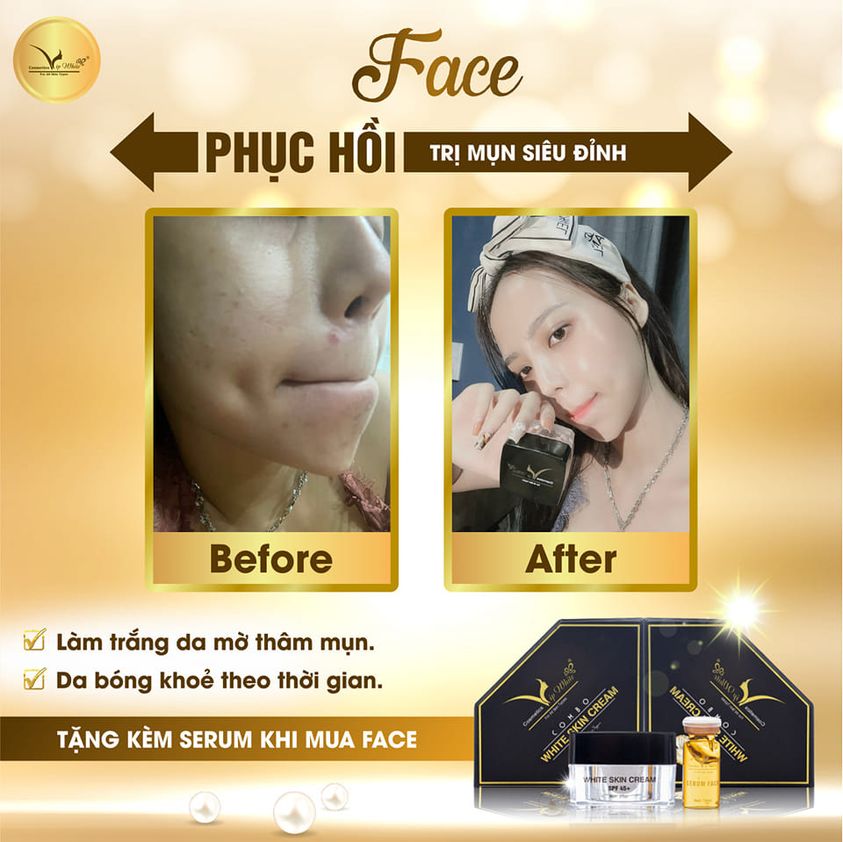 Kem Face Vip White Mang Làn Da Trắng Sáng Về Cho Bạn