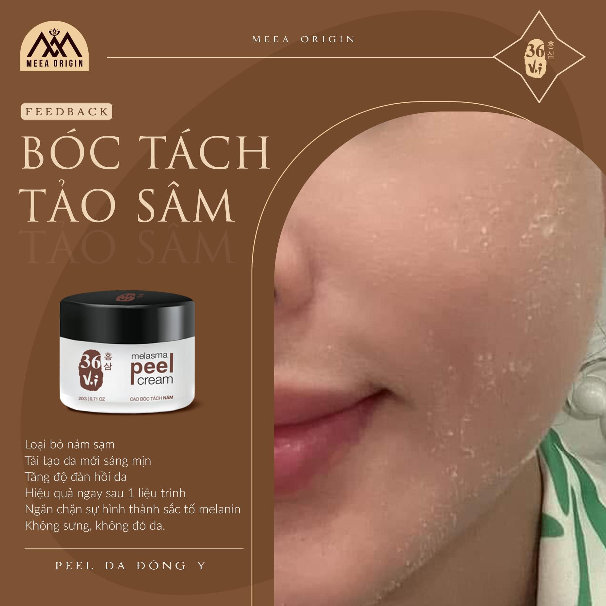 Peel da tảo sâm đông y 36 vị Meea Origin gải pháp peel da tại nhà