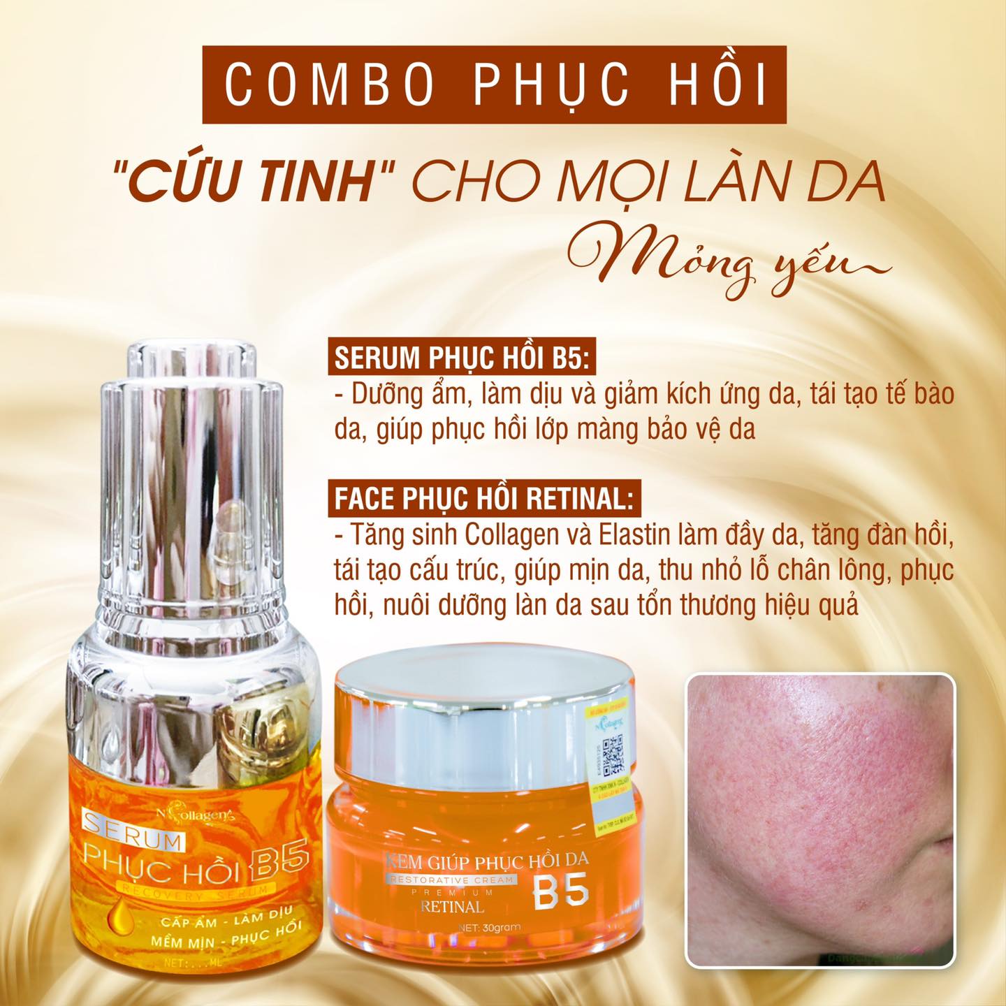 Combo phục hồi B5 là cứu tinh cho mọi làn da mỏng yếu