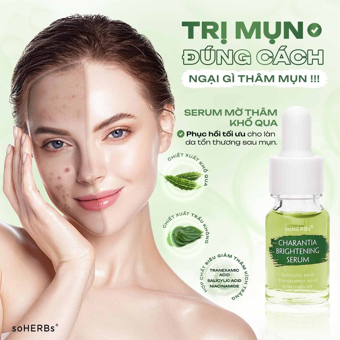 Trị mụn đúng cách ngại gì thâm mụn Serum đánh bay vùng thâm khổ qua