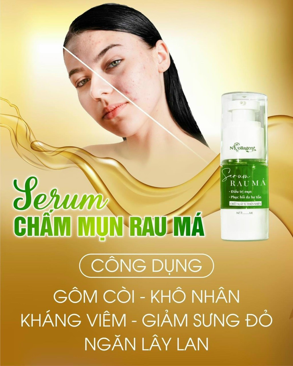 Giải pháp trị mụn đỉnh cao vừa lành vừa mạnh không tổn thương da