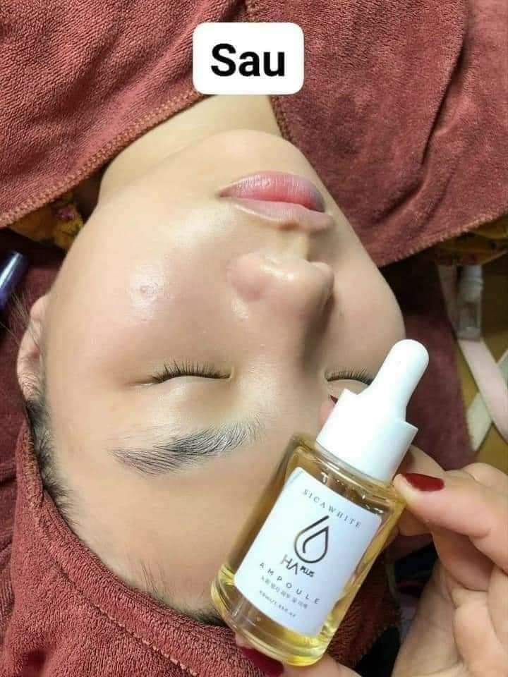 Serum HA cải tiến mới Ampoule HA da khỏe ẩm ướt