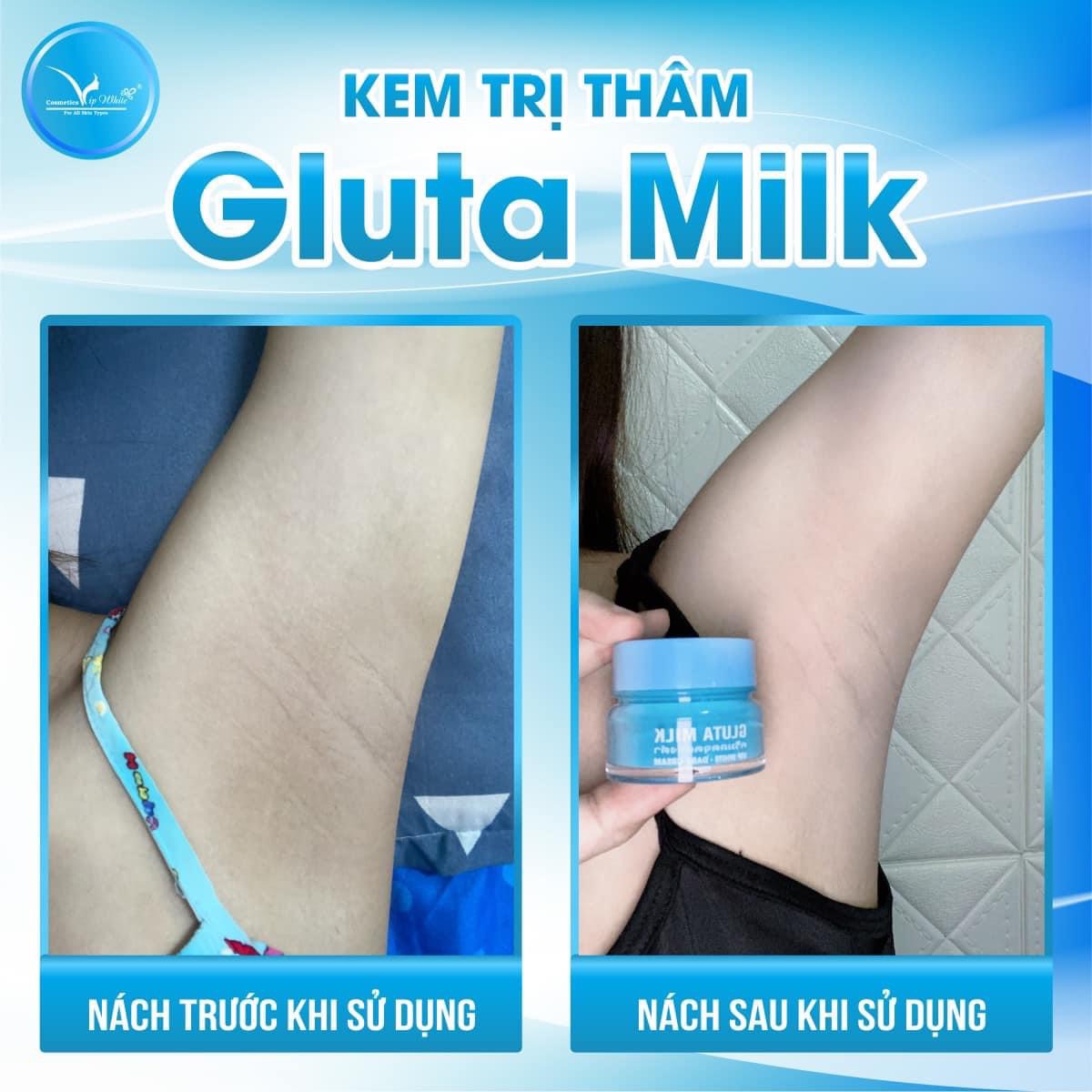 Mấy ca thâm nhẹ như này Gluta Milk giải quyết nhanh gọn lẹ lắm Còn ca nào khó hơn không