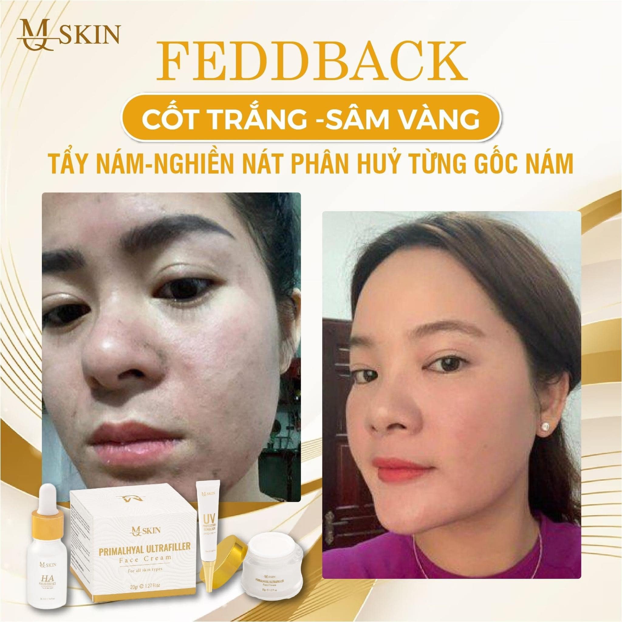 Combo kem face sâm vàng MQ Skin chính hãng giúp da mềm mại dẻo dai hơn và có khả năng tái sinh