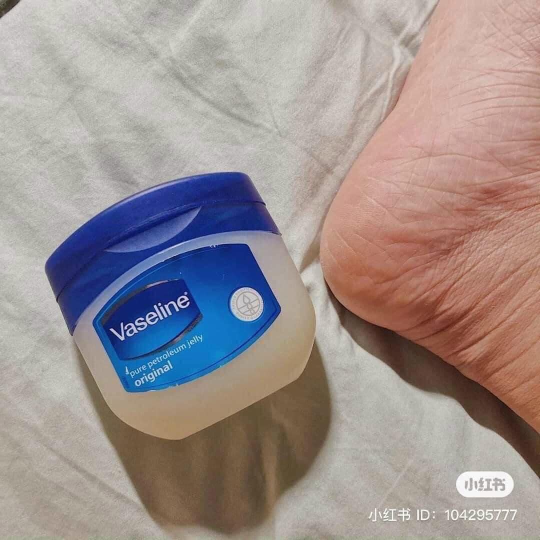 Sáp dưỡng ẩm VaSeline trị nẻ Mỹ là sản phẩm tuyệt vời cần có trong mọi gia đình