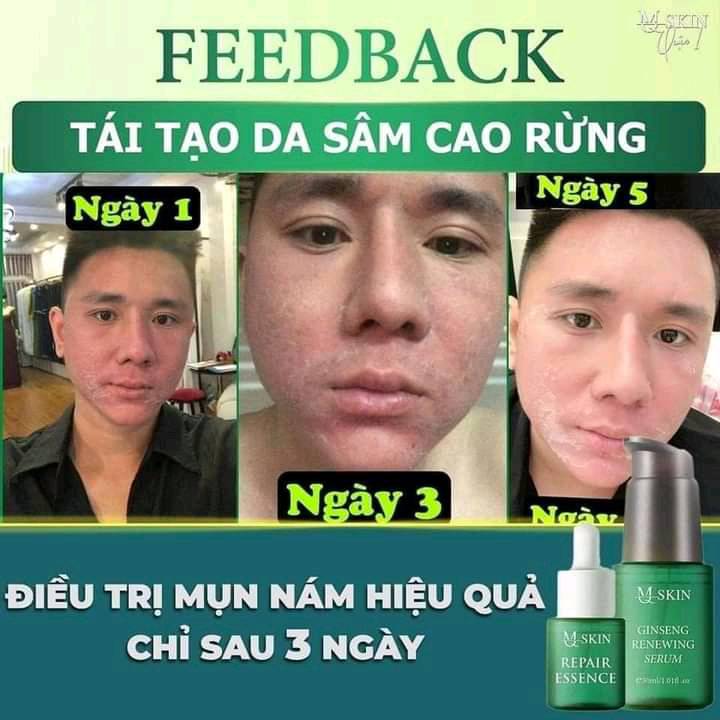 Combo tái tạo Sâm Cau Rừng MQ Skin