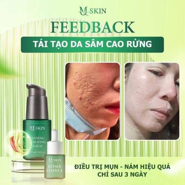 Combo tái tạo Sâm Cau Rừng MQ Skin